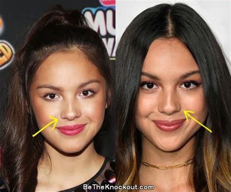 did olivia rodrigo get breast implants|19 Stars Who Have Opened Up About Getting Plastic。